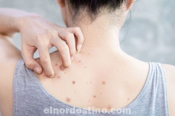La piel contiene secreciones que pueden destruir bacterias y la melanina, que es un pigmento químico que sirve como defensa contra los rayos ultravioleta que pueden dañar las células de la piel. (Foto: Fanpage en Facebook de Universidad Sudamericana).